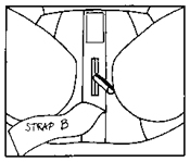 radiation-implant-brief-step-2