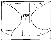 radiation-implant-brief-step-3